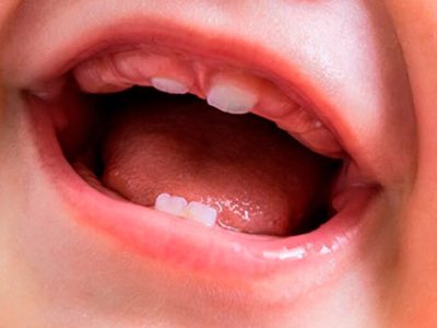 cuandoempiezanasalirlosdientes